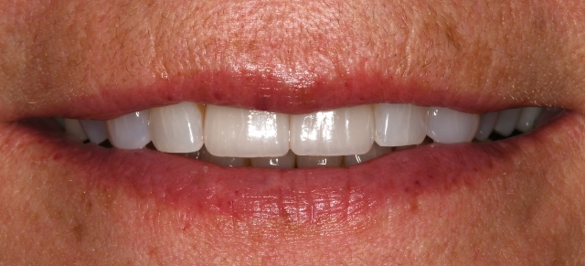After