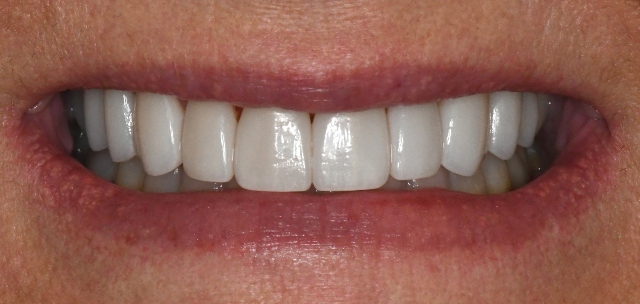 After